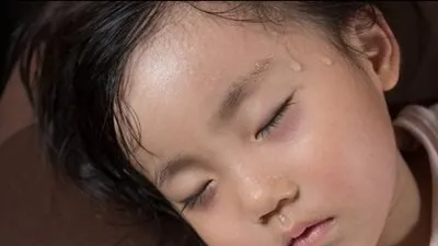 مرض فرط التعرق في الأطفال: الأسباب والأعراض وطرق العلاج