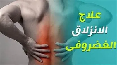 الانزلاق الغضروفي: ما هو وطرق تجنب الإصابة به