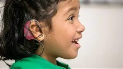 علاج جيني ينجح في إعادة السمع لـ4 أطفال من الصم