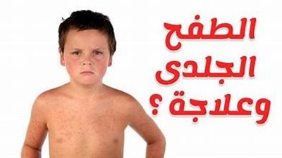 الطفح الجلدي عند الأطفال.. اسبابه وطرق علاجه