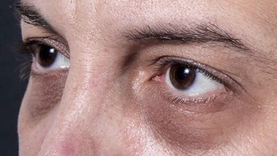 إستراتيجيات فعالة للتخلص من الهالات السوداء تحت العيون وتحسين مظهر البشرة