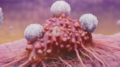 أستاذ أورام تزف بشرى سارة بشأن سرطان عنق الرحم في نهاية 2030