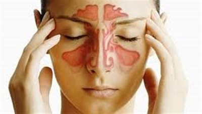 علاج الجيوب الأنفية..أبرز النصائح من الأطباء لعلاج الجيوب الأنفية 