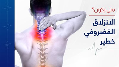 طرق علاج الانزلاق الغضروفي.. ( تعرف على طرق العلاج دون تدخل جراحي)