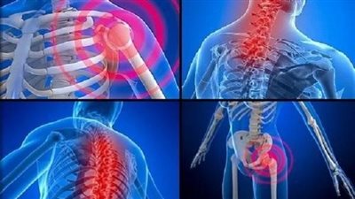  الم العظام.. تعرف على أسبابه وأعراضه وسُبل العلاج 