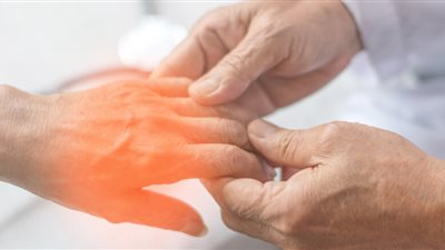 التهاب الأعصاب.. تعرف على الأسباب وكيفية العلاج 