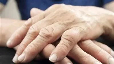 التهاب المفاصل الروماتويدي: فهم متكامل للأعراض وتأثيره على الحياة اليومية