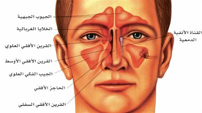 التهاب الجيوب الأنفية: تعرف على الأسباب والأعراض وطرق العلاج