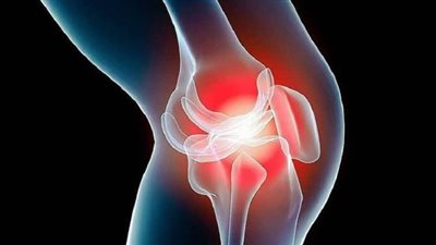 7 طرق فعالة لعلاج التهاب المفاصل.. تعرف عليها