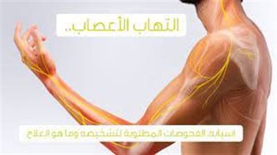 النيران الحارقة.. أسباب وأعراض وطرق علاج التهاب الأعصاب