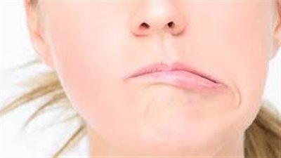 بين وجه الضحك والدموع: أسباب وأعراض وسبل علاج العصب السابع 