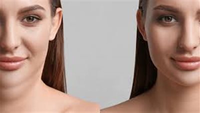 5 مشروبات تخلصك من اللغلوغ.. تعرفي عليها