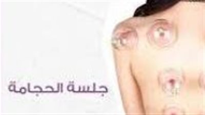 فوائد الحجامة للنساء وشروطها: ما يجب معرفته قبل اللجوء إلى هذا العلاج التقليدي