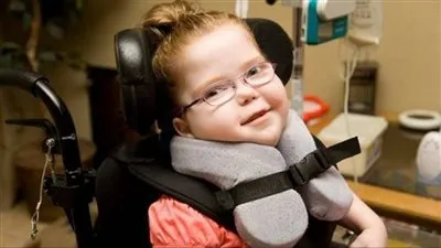  الشلل الدماغي الحركي: تعريف الأسباب وسبل العلاج