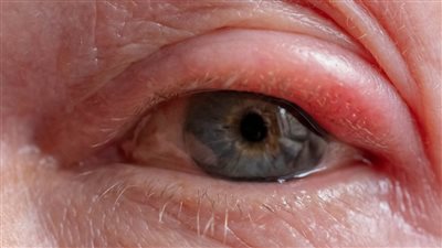 رؤية صحية: خطوات عملية للحفاظ على عيونك في أفضل حالاتها