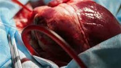 الذكاء الاصطناعي يتنبأ بالبقاء على قيد الحياة بعد جراحة القلب