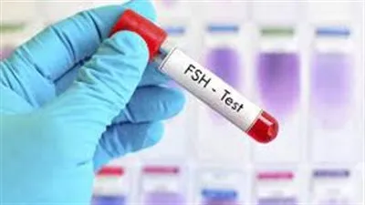 تحليل FSH: رؤية عميقة لصحة الإنجاب والتوازن الهرموني