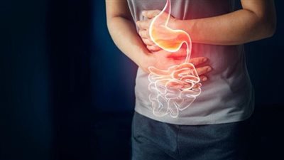 حرقة المعدة: أسبابها ونصائح التعامل معها