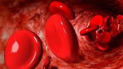 الانسداد التام في الأوعية الدموية..كيف تحمي نفسك؟