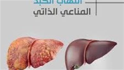 التهاب الكبد المناعي الذاتي.. كيف تعرف أنك مصاب؟