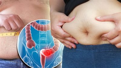 انتفاخ البطن: تعرف على أسبابه وسبل الوقاية 