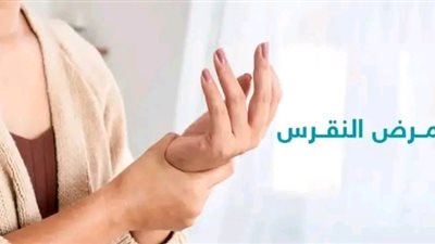 ما هو مرض النقرس وما هي أسباب الإصابة بها؟