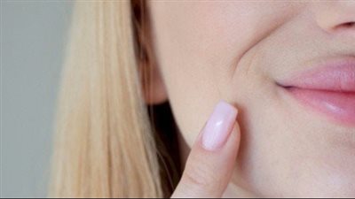 طريقة لإزالة السواد حول الفم.. أسرار في عالم العناية بالبشرة