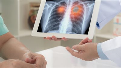 حصاد 2023.. ماذا قدمت مستشفيات الأمراض الصدرية للمواطنين؟