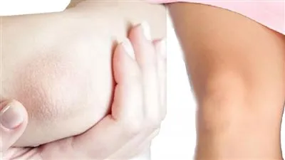 أسرار نعومة الركب والأكواع.. دليل شامل عن كيفية تقشيرها بفعالية والعناية المثلى