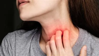 علاج حساسية الحنجرة.. إرشادات فعّالة للتخفيف من الأعراض وتحسين الجودة الحياتية