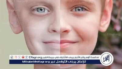 سرطان الأطفال.. علامة جديدة تم اكتشافها في المرض