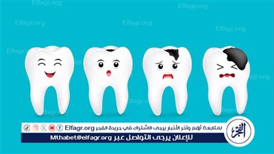 تسوس الأسنان: أسبابه وكيفية الوقاية منه