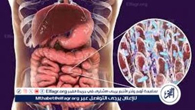  فهم أسباب التهاب القولون وكيفية الوقاية منها