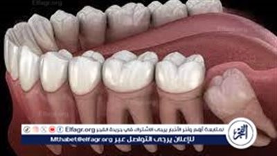 ضرورة غسيل الأسنان والعناية بها: سر الصحة الفموية والعامة