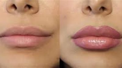 وصفات سحرية لتكبير الشفايف بشكل دائم.. لا تفوتيها