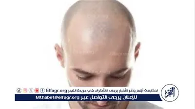 سؤال حول حكم زراعة الشعر للصلع
