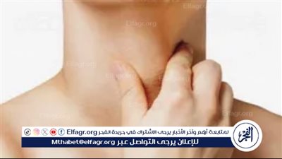 نصائح مهمة لمرضى الغدة الدرقية أثناء الصيام في رمضان