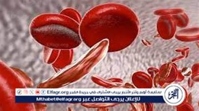 الدكتور حسام موافي: الأنيميا ليست مرضًا وتوجد مستشفيات حكومية مجانية للعلاج