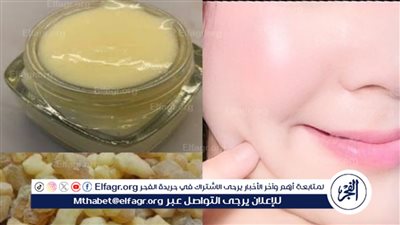 وصفة طبيعية آمنة للقضاء على حب الشباب نهائيًا هتحسوا بالفرق من أول استعمال
