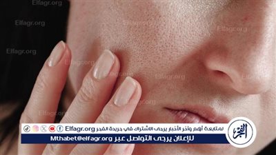 جفاف البشرة: أسبابه وعلاجه والوقاية منه 