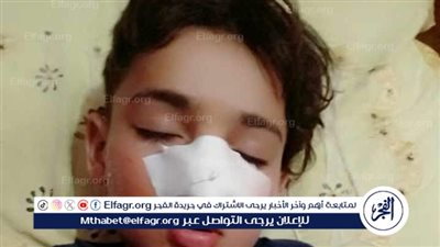 إصابة طفل إثر سقوطه من أعلى سطح المنزل في الفيوم 