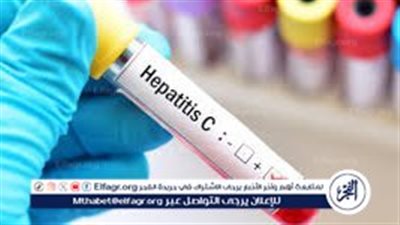 العلاج بالمجان| استشاري كبد يكشف آليات الدولة لمواجهة فيروس سي