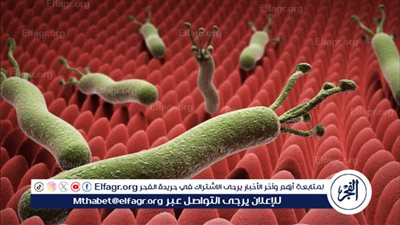 أستاذ أمراض معدية: 80% من المصابين بجرثومة المعدة لا يعانون من أعراض واضحة