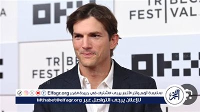 مشاهير ندموا على خضوعهم لعمليات التجميل (تقرير)