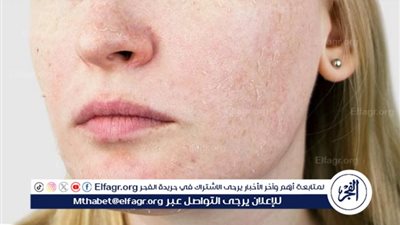 فوائد الجرجير للبشرة الجافة: تحسين الترطيب والمرونة بطرق طبيعية