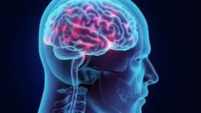 ما هو التأخر العقلي المتوسط ؟