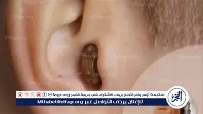 استخراج سماعة غش من أذن طالب في مستشفى نجع حمادي بقنا