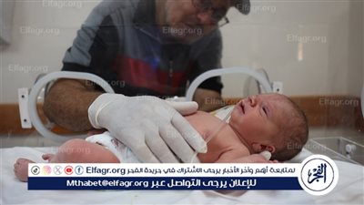 صندوق الأمم المتحدة للسكان: سوء التغذية بغزة يشكل خطرا كبيرا