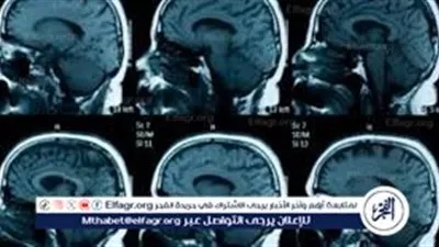 ضمور المخ البسيط عند الأطفال.. تعرف على أعراضه وطرق علاجه