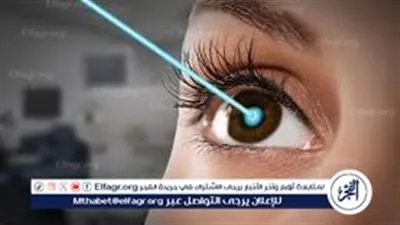  عملية الليزك.. تصحيح البصر وتفاصيلها وخطواتها